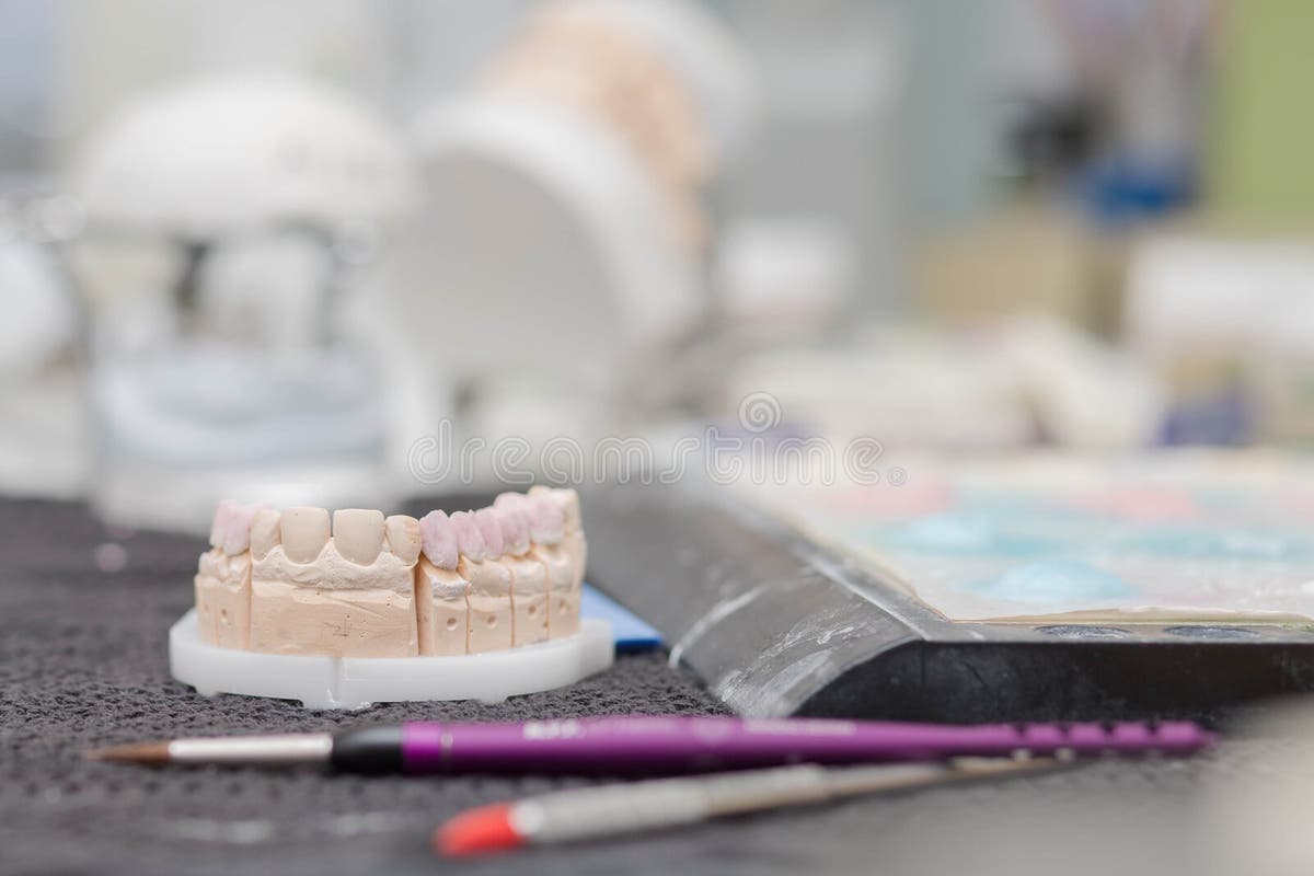 Dental Stone Cast Stock Photos Free & RoyaltyFree Stock Photos from