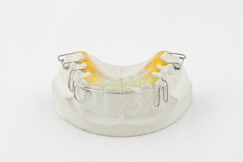 Dental plate stock image. Image of denture, implants 31828681