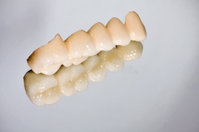 Dental porcelain bridge stock image. Image of dentist 28859407