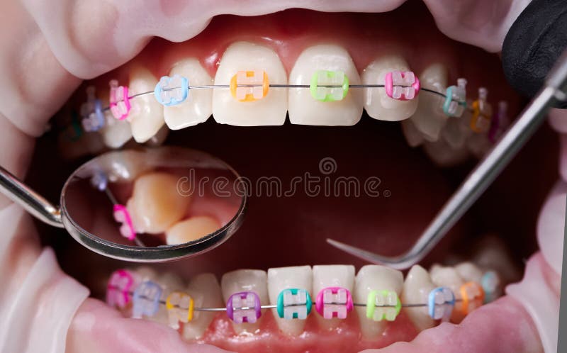 Rubber teeth sale