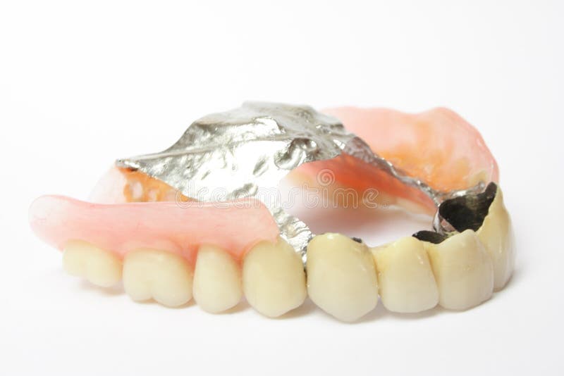 Dental Prosthesis, Dentures Porcelain Stock Photo Image of porcelain