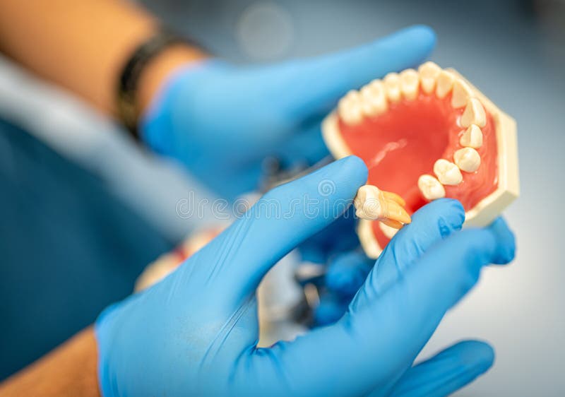 Dental Prosthesis, Dentures, Prosthetics Work. Prosthetics Hands while