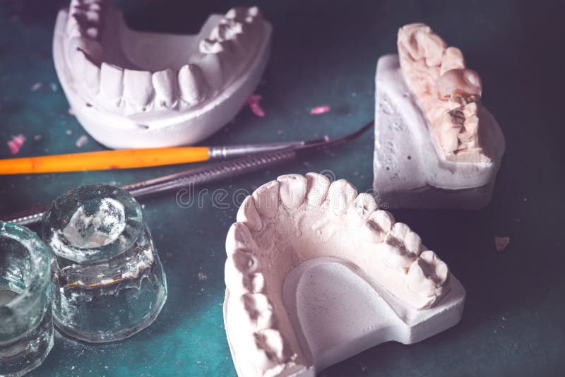 Dental Prosthesis Prosthetic Laboratory Stock Photo Image of