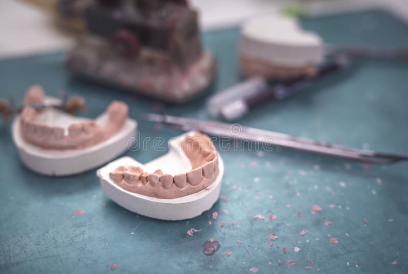 Dental Prosthesis Work Equipment Stock Photo Image of intraoral