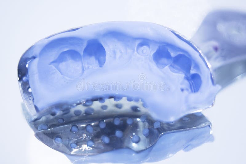Dental prosthetics gel tooth mold stock image Dental prosthetics gel tooth mold stock image