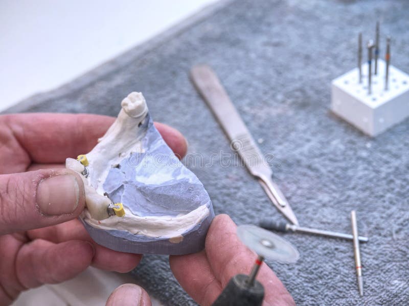 Dental Prosthetics Work with Tools and Ceramic Crown Denture Stock