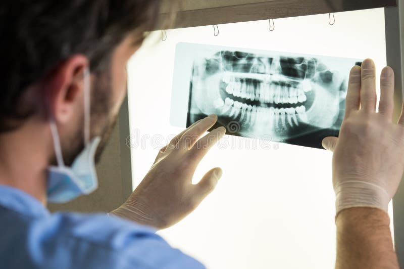 Dental xray stock photo. Image of lightbox, holding 53142078