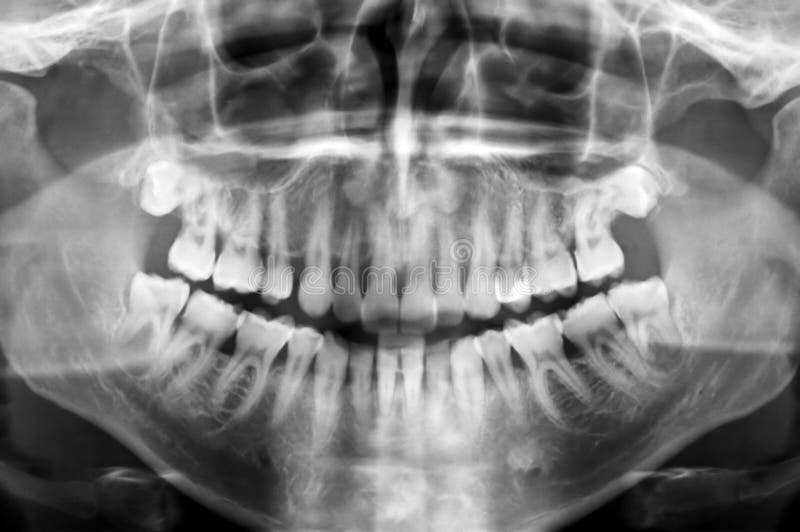 Dental scan torrent free Dental scan torrent free