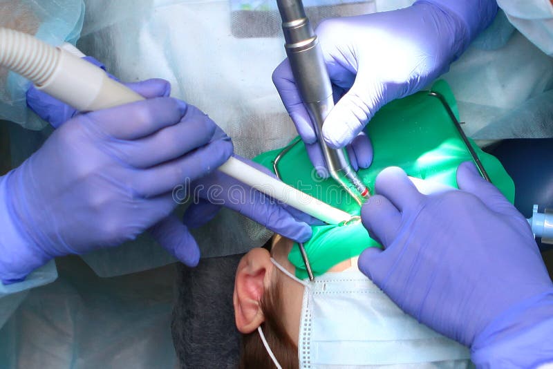 Dental Surgery Under General Anesthesia. Treatment of Deep Caries in a