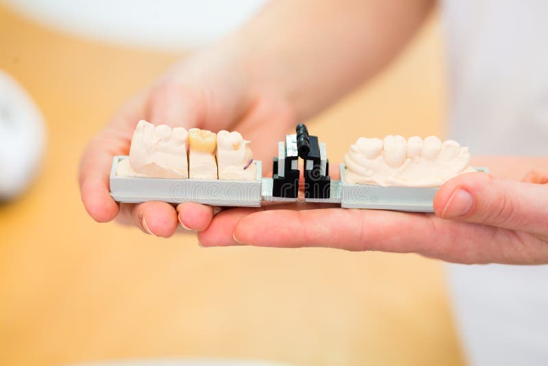 Tools for Dental Technician Stock Photo Image of arrangement, closeup