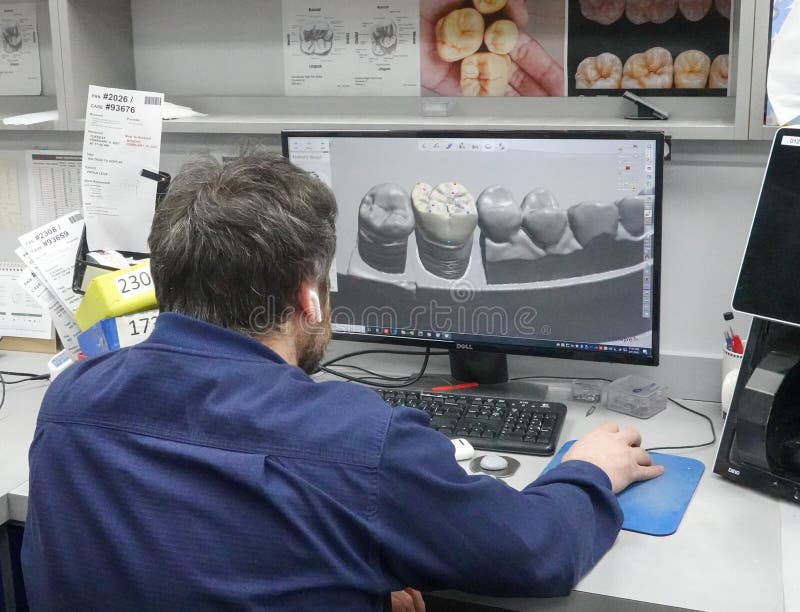 dental technician cad cam dental technician cad cam