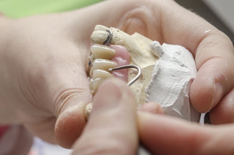 Dental Technician Doing Partial Dentures of Acrylic Resins. Stock Image