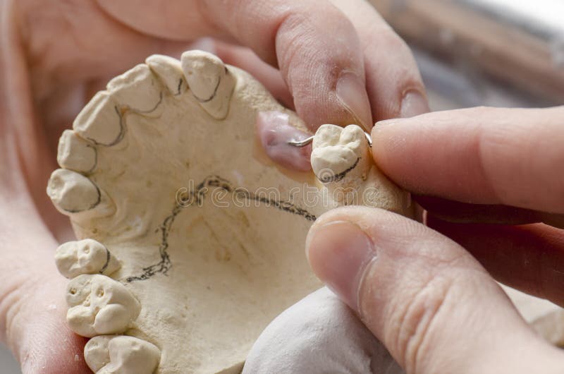 Dental Technician Doing Partial Dentures of Acrylic Resins. Stock Image
