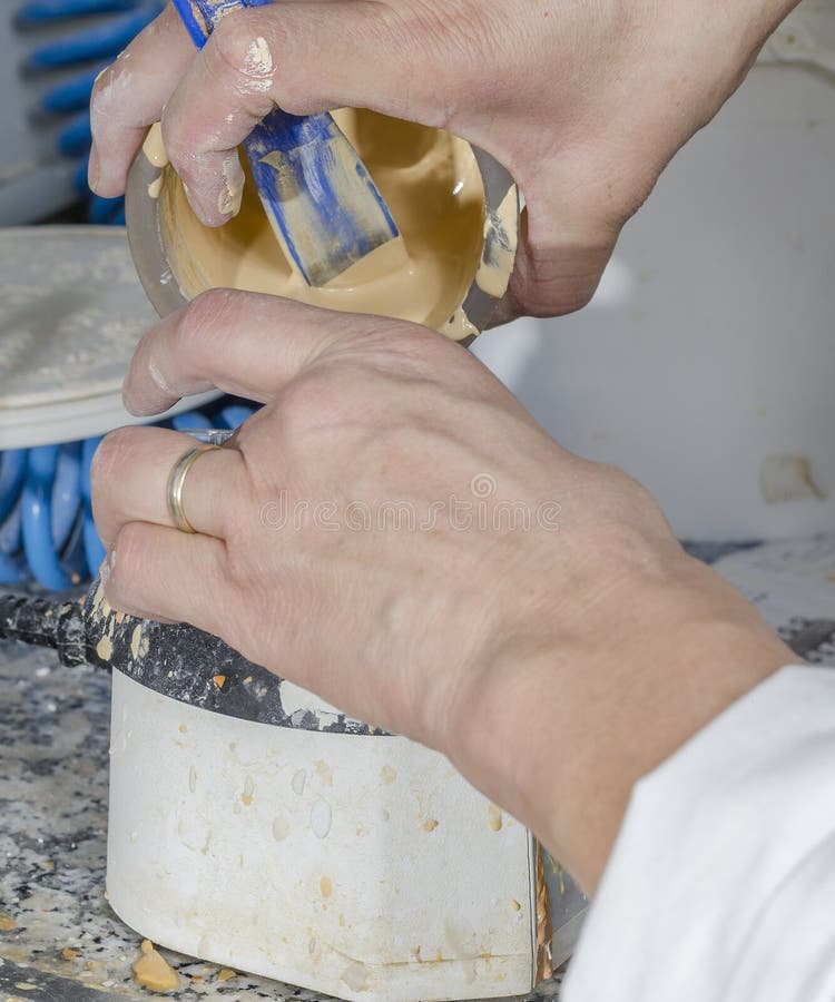 Dental Technician is Emptying Plaster Models. Stock Image Image of