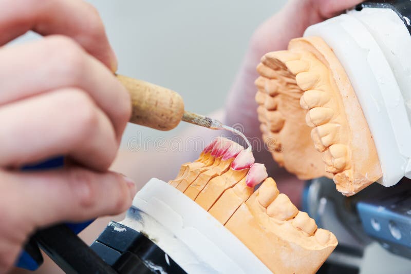 Dental Technician or Prosthesis Work. Prosthetic Dentistry Process