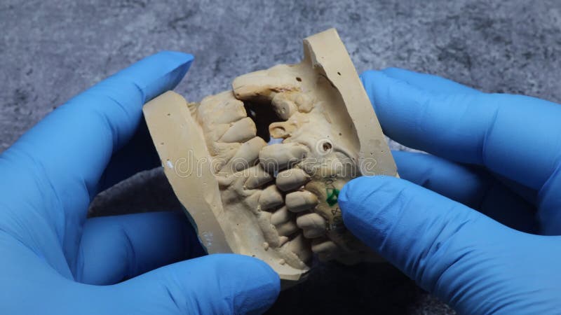 Dental technician looks at a model of the teeth stock footage