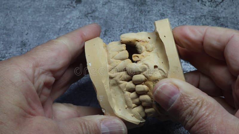 Dental technician looks at a model of the teeth stock video footage