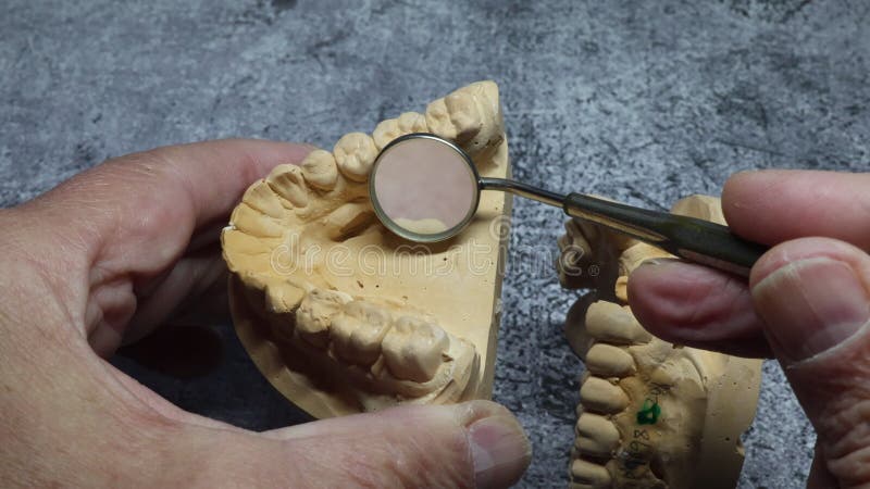 Dental technician looks at a model of the teeth stock video footage