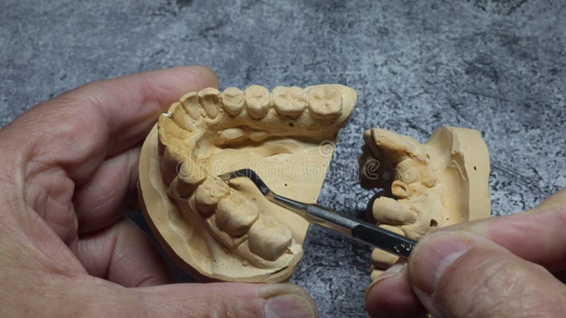 Dental technician looks at a model of the teeth stock video