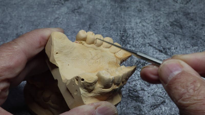 Dental technician looks at a model of the teeth stock video footage