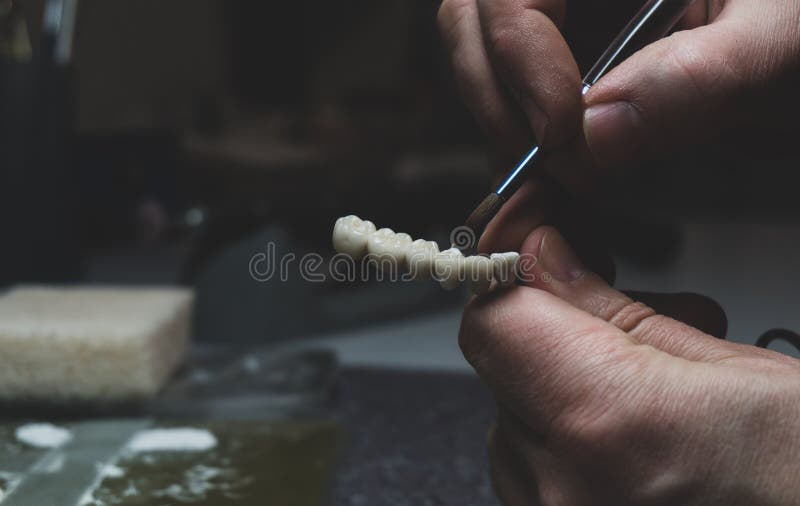 A Dental Technician Makes a Prosthetic Teeth. Laboratory. Closeup