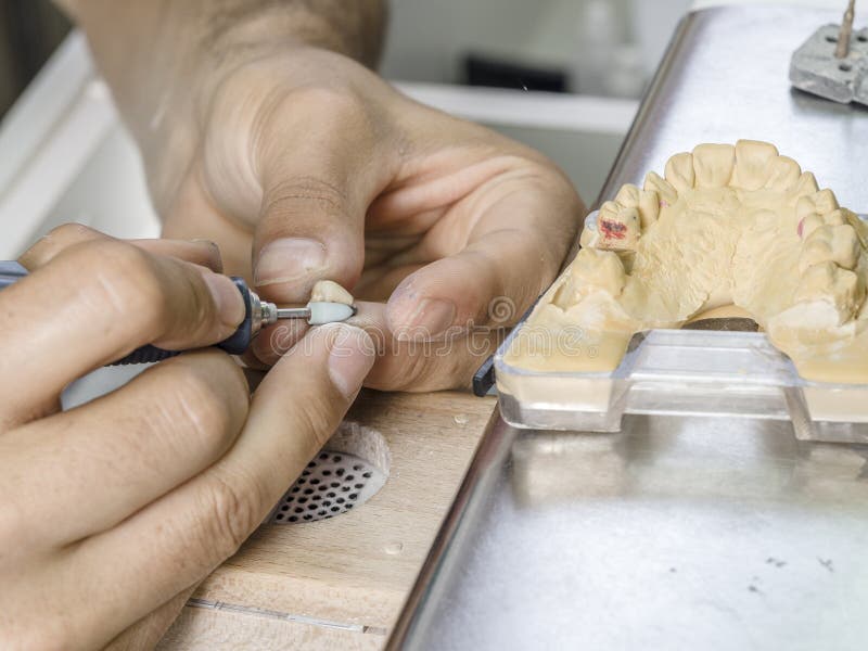 Dental Technician Modelling an Implant Ceramic Tooth with a Drill