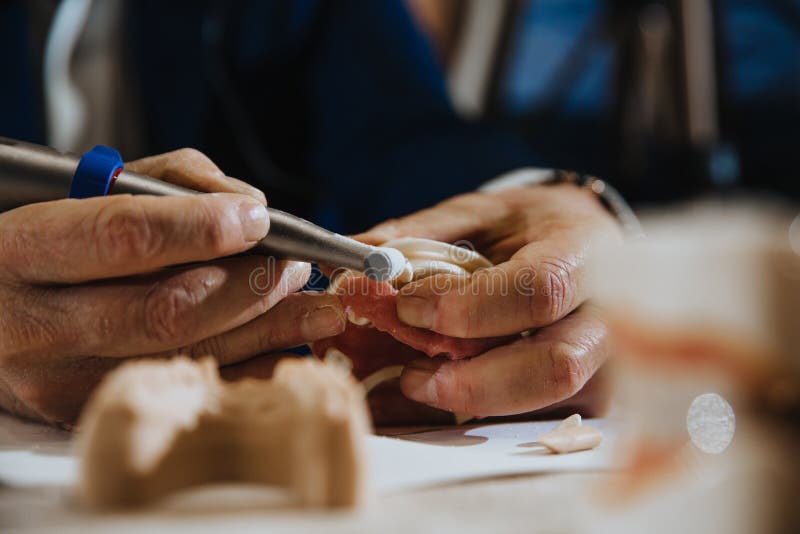 A Dental Technician Processes a Cast of the Jaw Stock Image Image of