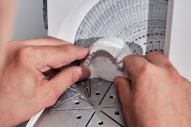 Dental Technician Trimming Excess Material from Plaster Models. Dental