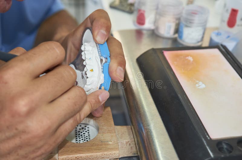 Dental technician using a brush with ceramic dental implants in