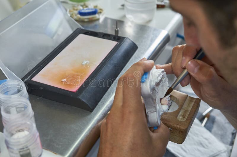 Dental technician using a brush with ceramic dental implants in