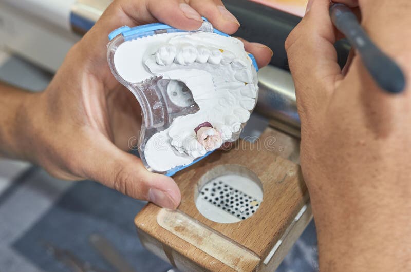 Dental Technician Using a Brush with Ceramic Dental Implants in Stock