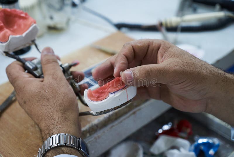 Dental Technician Using a Knife with Ceramic Dental Implants Stock