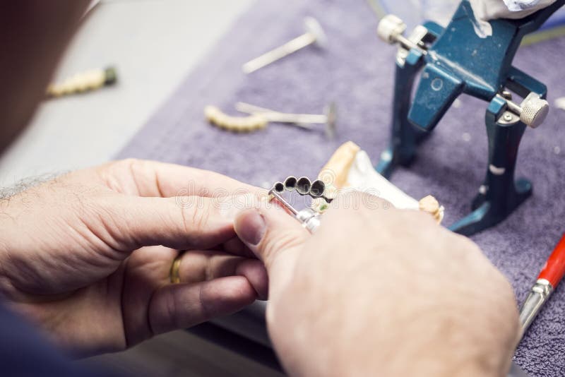Dental Technician Working on a Metallic Prosthesis Stock Photo Image
