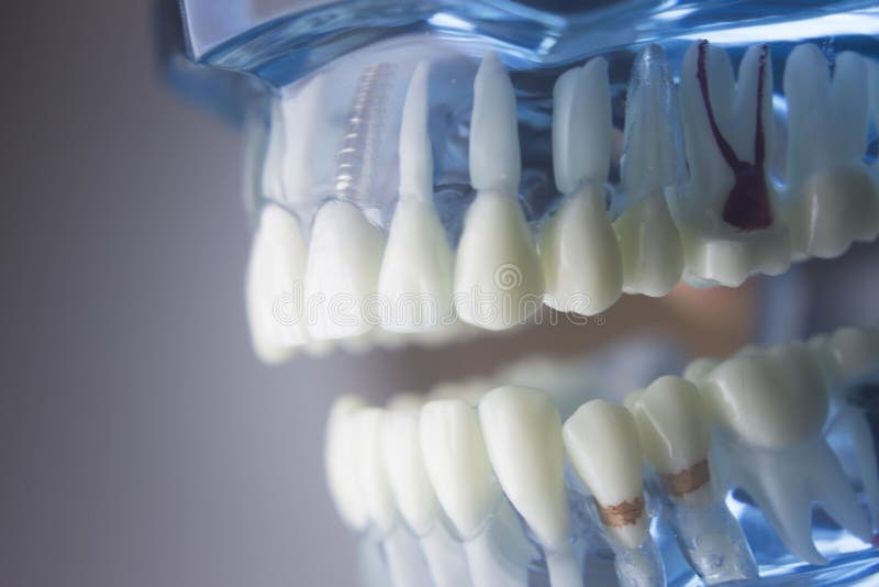 Zubní zubní zubní lékařství student, učení, výuka modelu a ukazují, zubů, kořenů, dásní, onemocnění dásní, zubního kazu a plaku.