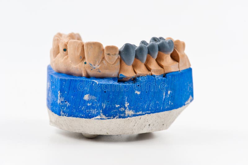 Dental wax model stock photo. Image of anatomy, background 16640062