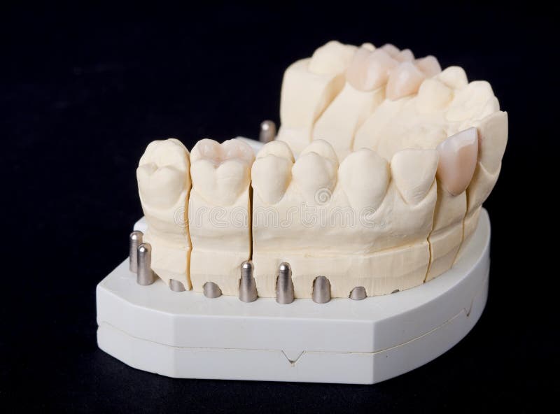 Dental wax model stock photo. Image of denture, molars 17692614
