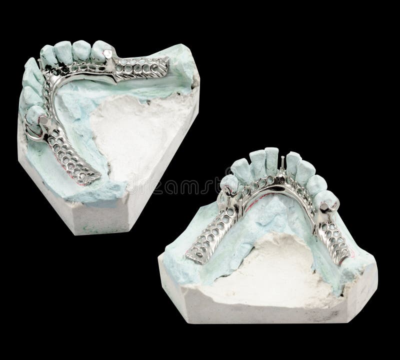 Dental Wire Bending For Make A Partial Denture Stock Image Image of