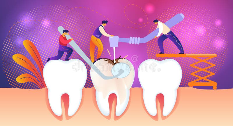 Dente non sano del gigante di Treate degli uomini con il foro della carie illustrazione vettoriale Dente non sano del gigante di Treate degli uomini con il foro della carie illustrazione vettoriale