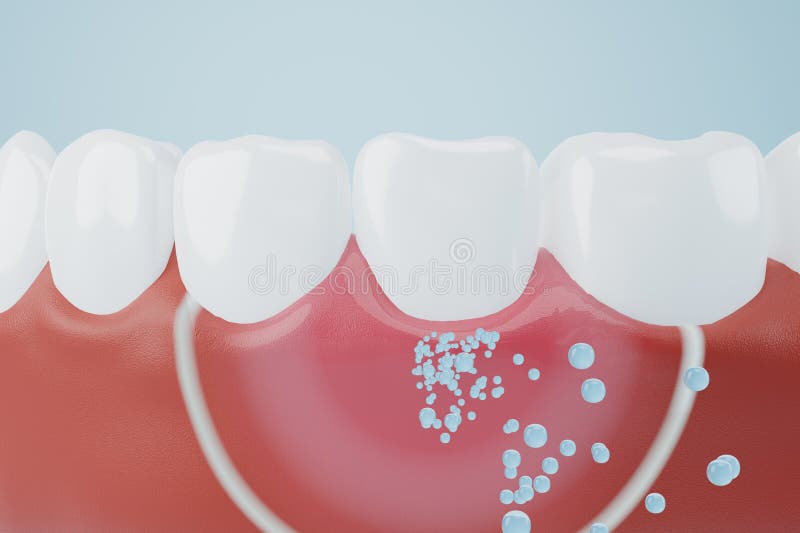 Bubble of toothpaste or fluoride molecule coating gums and teeth to protect oral hygiene. Toothpaste, fresh or bad breath protection concept. 3D rendering. Bubble of toothpaste or fluoride molecule coating gums and teeth to protect oral hygiene. Toothpaste, fresh or bad breath protection concept. 3D rendering.