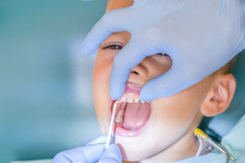 Dentist examining boy& x27;s teeth in clinic. A small patient in the dental chair smiles. Dantist treats teeth. close up view of stock images Dentist examining boy& x27;s teeth in clinic. A small patient in the dental chair smiles. Dantist treats teeth. close up view of stock images