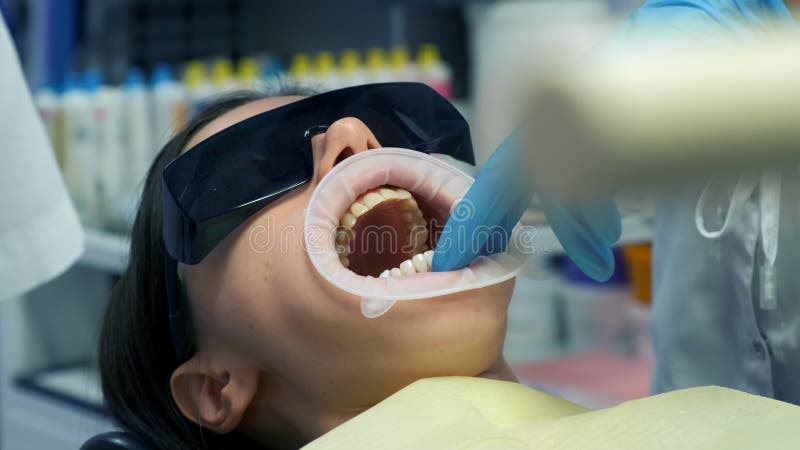 Dentist Fixes Braces with an Photopolymer Lamp in Dental Clinic