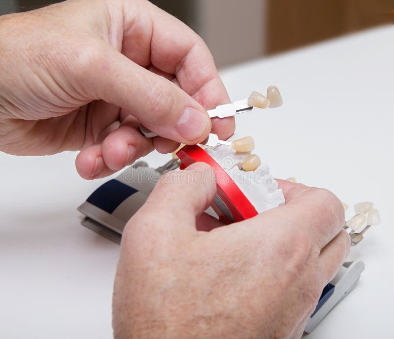 Dentist Hands with Color Guide and Plaster Model Stock Photo Image of