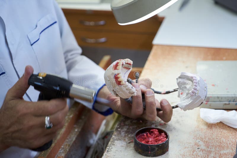 Dentist hands holds prostheses on a plaster jaw in the lab stock photo Dentist hands holds prostheses on a plaster jaw in the lab stock photo