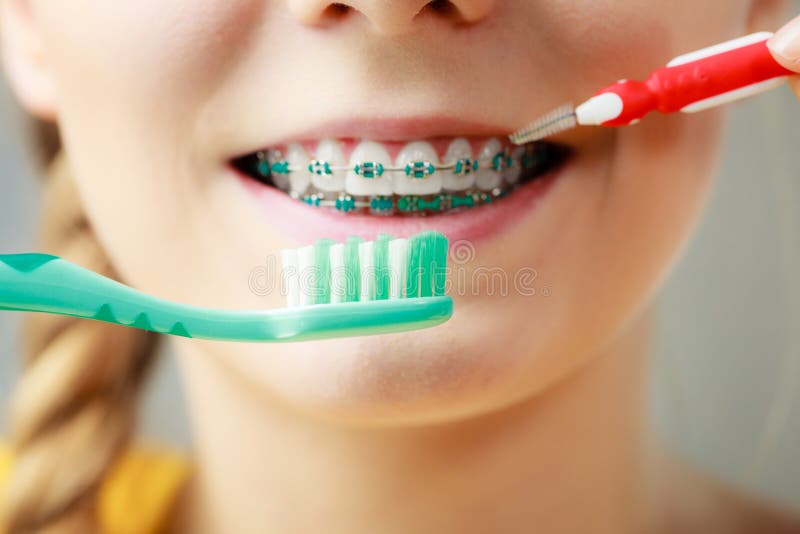 Girl with teeth braces using interdental and traditional brush