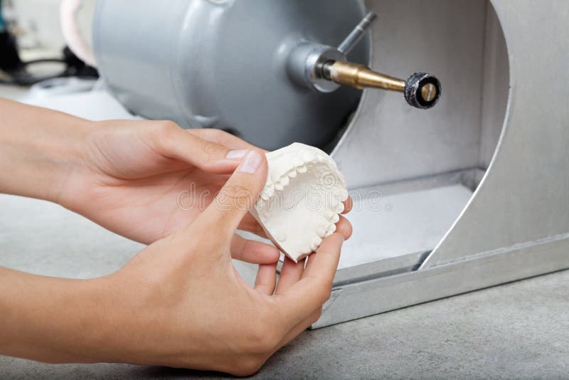 Dentist S Hands Holding Dental Plaster Mold Stock Image Image of cast