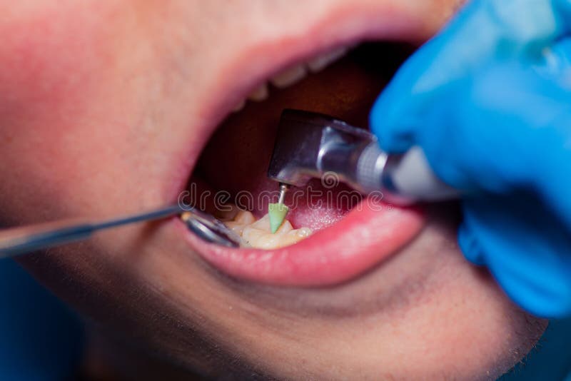 Dentist stock image. Image of clean, checkup, heal, dentistry 64335743