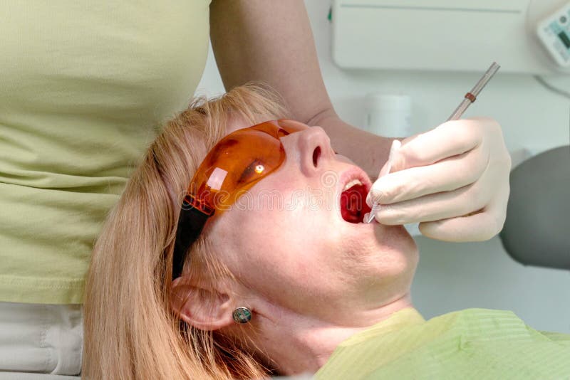 Dentist use a anesthetic oral gel to numb the area around tooth before injection royalty free stock photography Dentist use a anesthetic oral gel to numb the area around tooth before injection royalty free stock photography