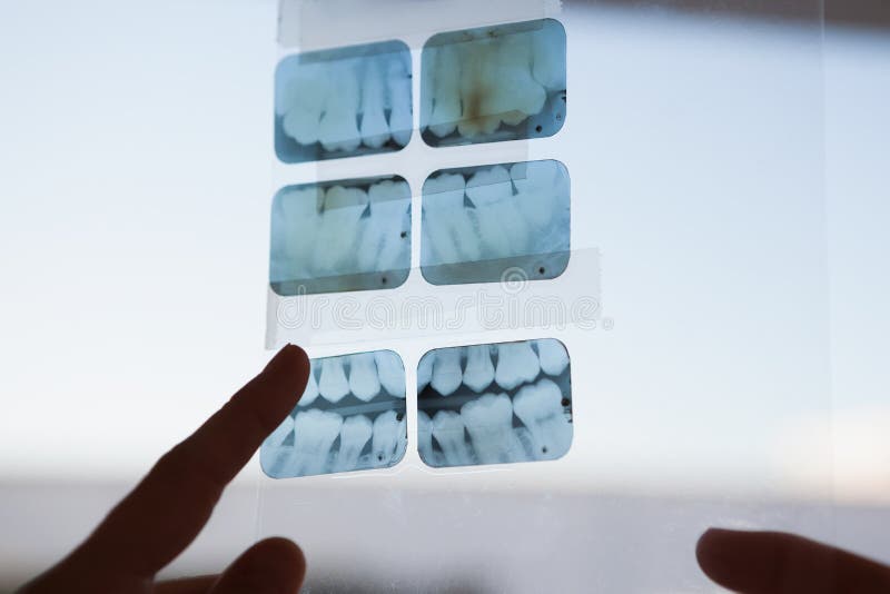 Dentists looking and pointing to xray at the dental clinic. Dentists looking and pointing to xray at the dental clinic