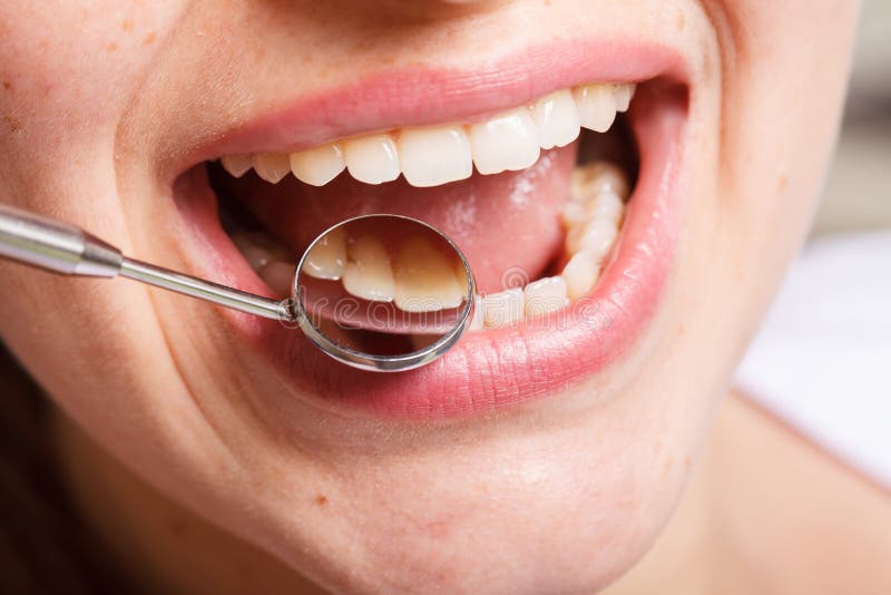 Dentistry, Dental , Mouth and Teeth Close Up Smiling Stock Image