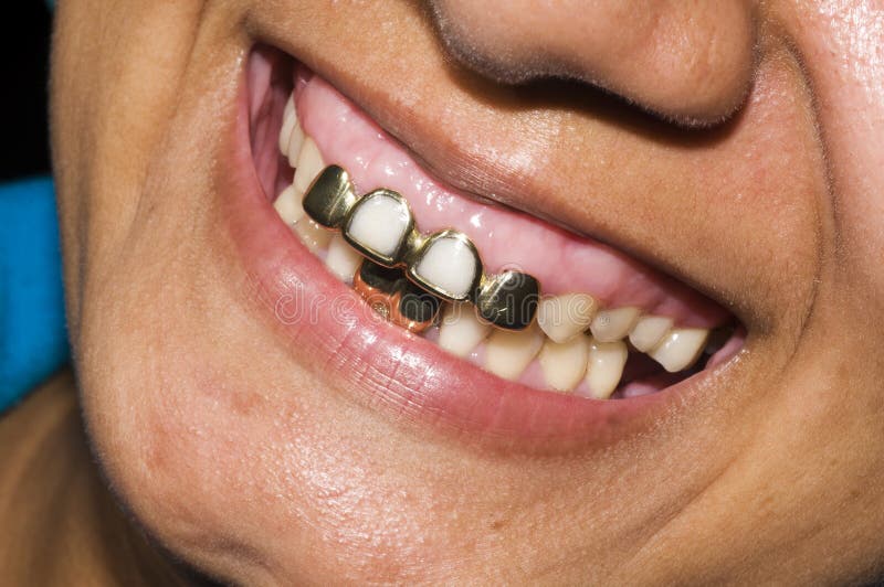 Dentisty gebürtige Maisinsel Nicaragua der Goldzähne stockbilder Dentisty gebürtige Maisinsel Nicaragua der Goldzähne stockbilder